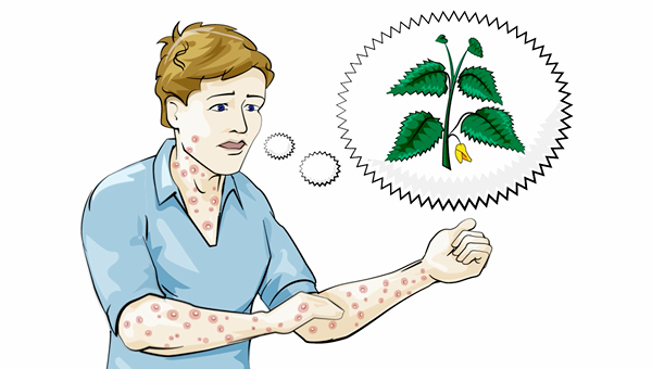 Vorschau für Vektorgrafik Beispiel von What's the Story zum Erklärvideo Anaphylaxie
